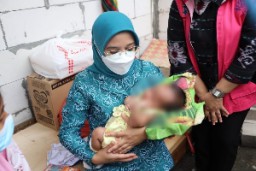 Ketua TP PKK Rini Bersama Baznaz Bantu Anak Hidrosefalus Dan Lansia